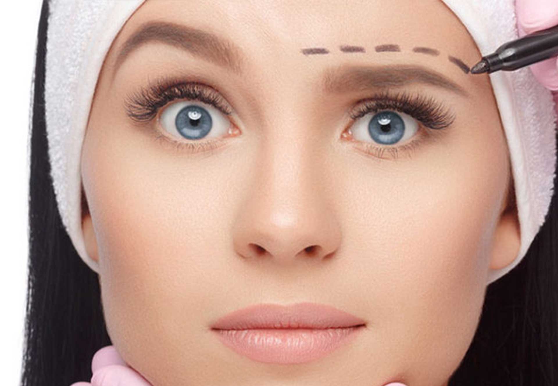 Eyebrow Lift - ASTRAMEDICA