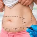 Liposuction cost in Istanbul